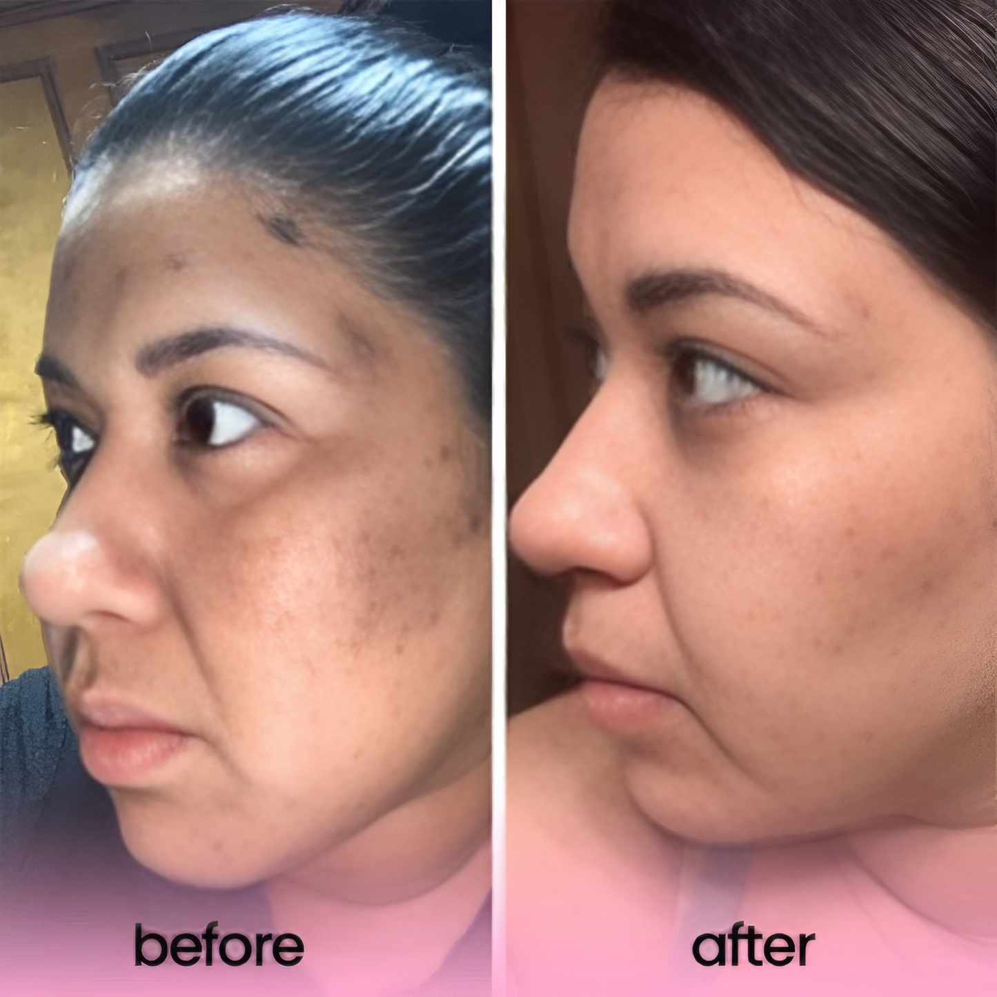 Kojic Acid & Turmeric Cleansing Pads (Original)